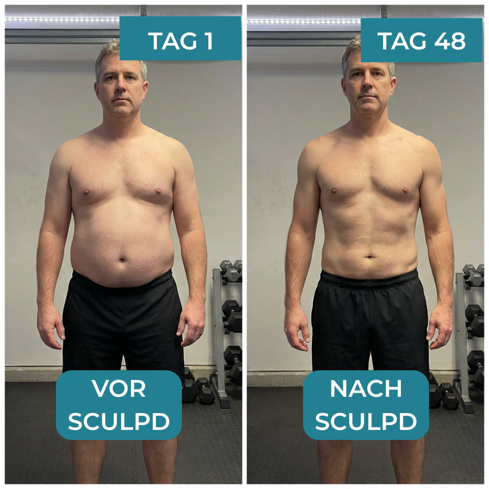 SCULPD™ 4.0  Endlich ein Tag, an dem du nicht an deinen Bauch denkst.
